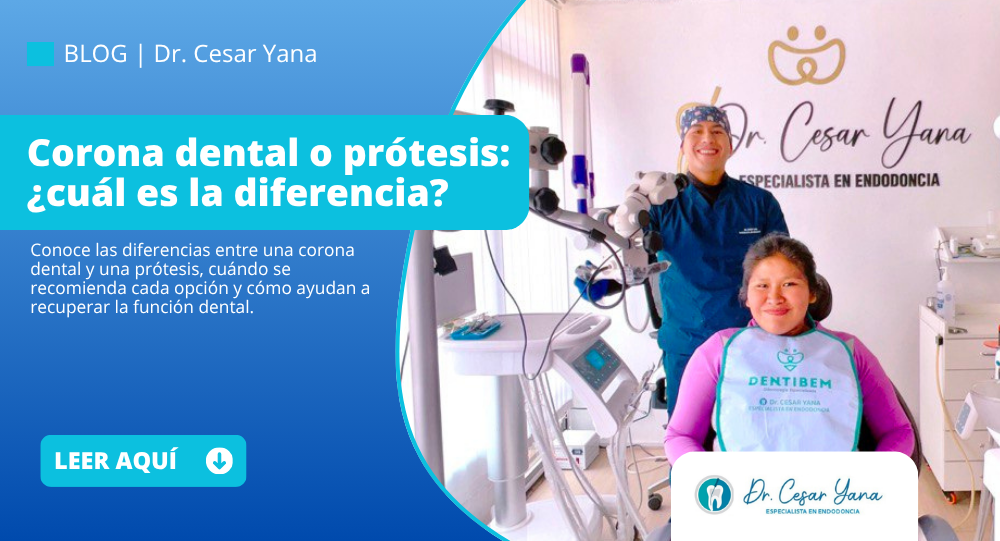 Comparación de una corona dental y una prótesis dental utilizadas en rehabilitación oral.