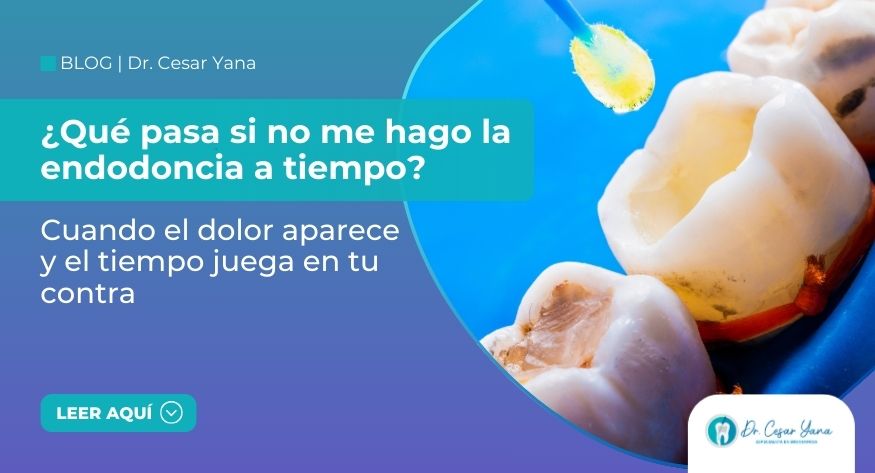 ¿Qué pasa si no me hago la endodoncia a tiempo?