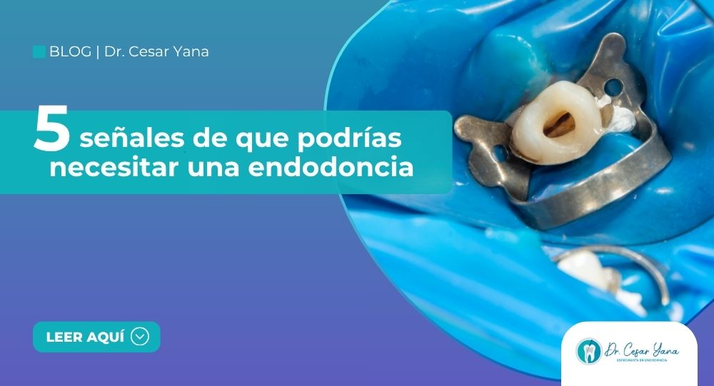 ¿Sientes dolor dental o sensibilidad persistente? Descubre 5 señales de que podrías necesitar una endodoncia con el Dr. César Yana en Juliaca.