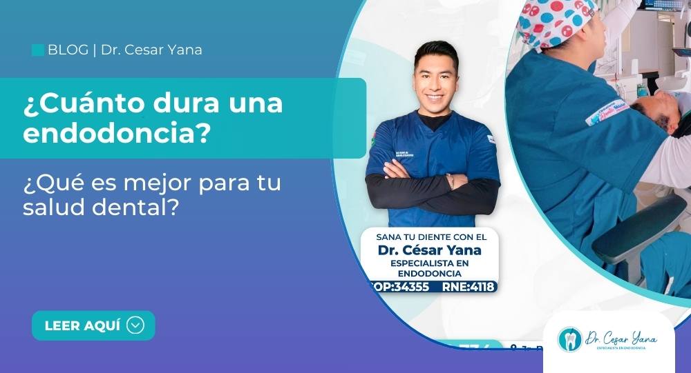 cuánto dura una endodoncia en Juliaca