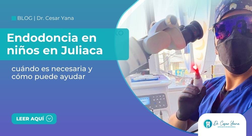 endodoncia en niños en Juliaca
