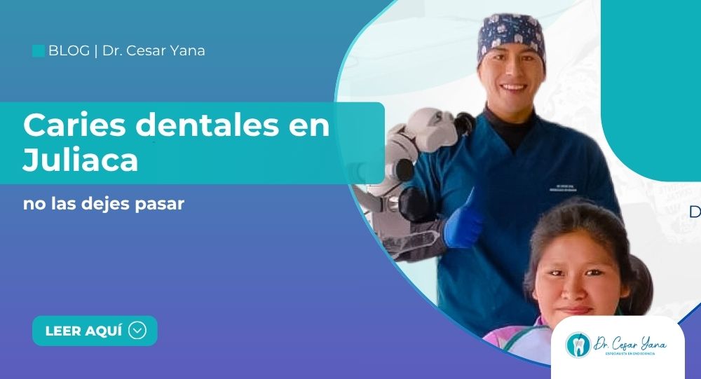 caries dentales en Juliaca