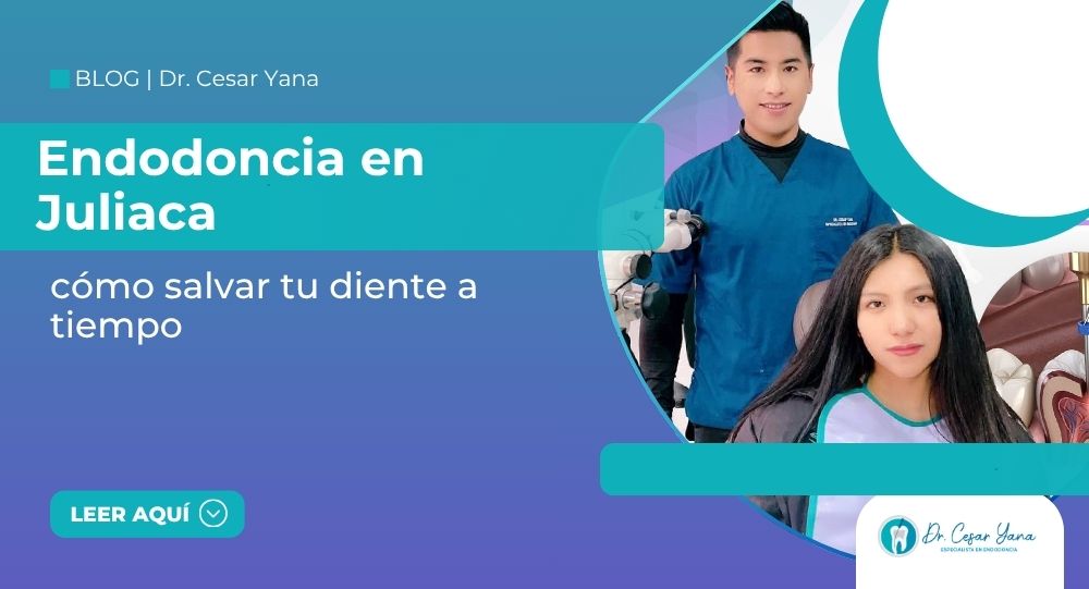 endodoncia en Juliaca