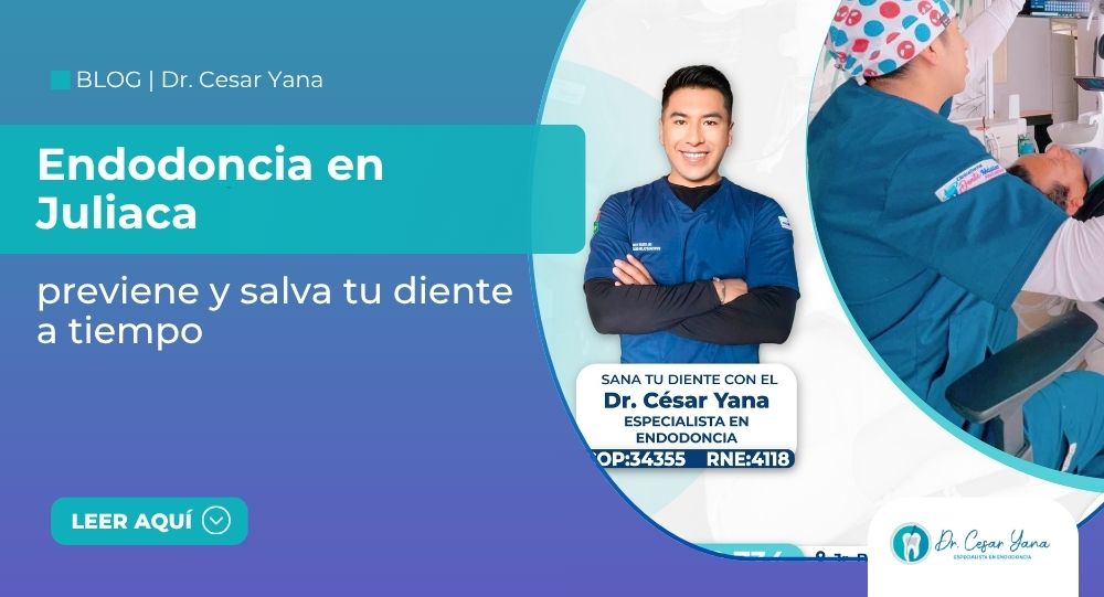 endodoncia en Juliaca