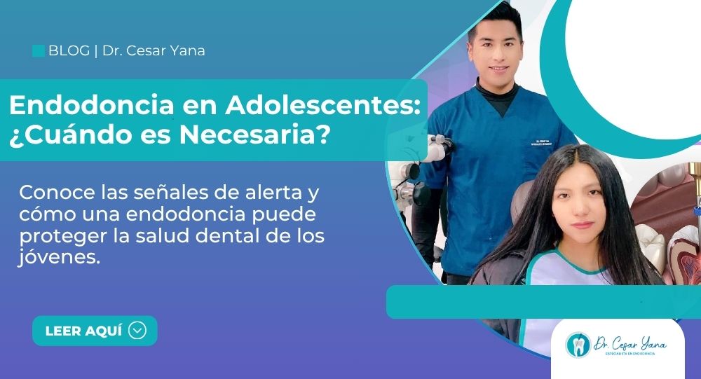 Endodoncia en adolescentes en Juliaca
